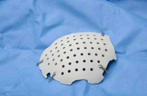 PEEK材料.png PEEK材料.png